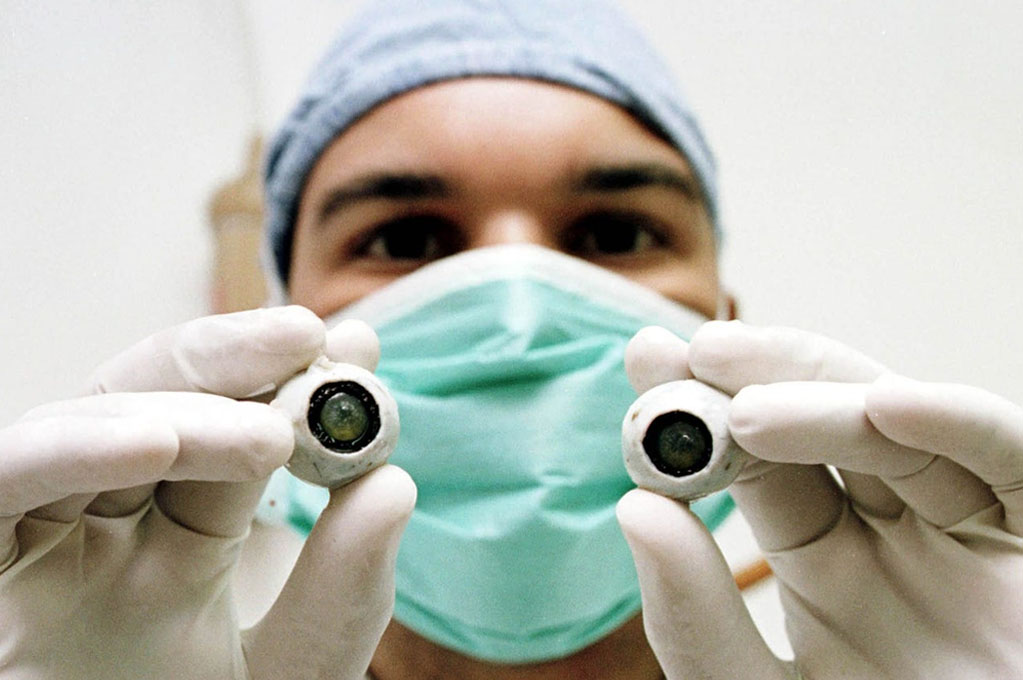 Primeiro transplante de córnea artificial do mundo restaura visão de homem cego