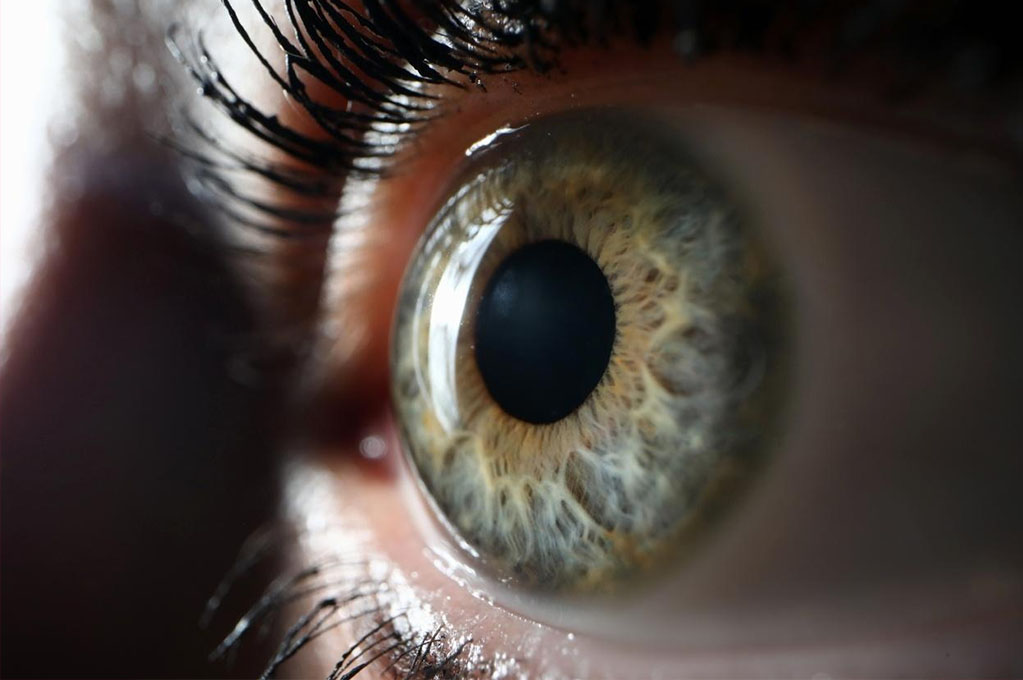 Miopia, a porta para o glaucoma